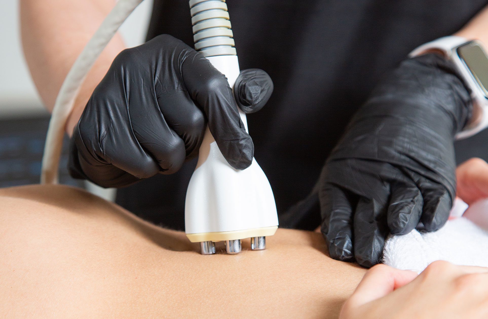Skin Tightening Treatment