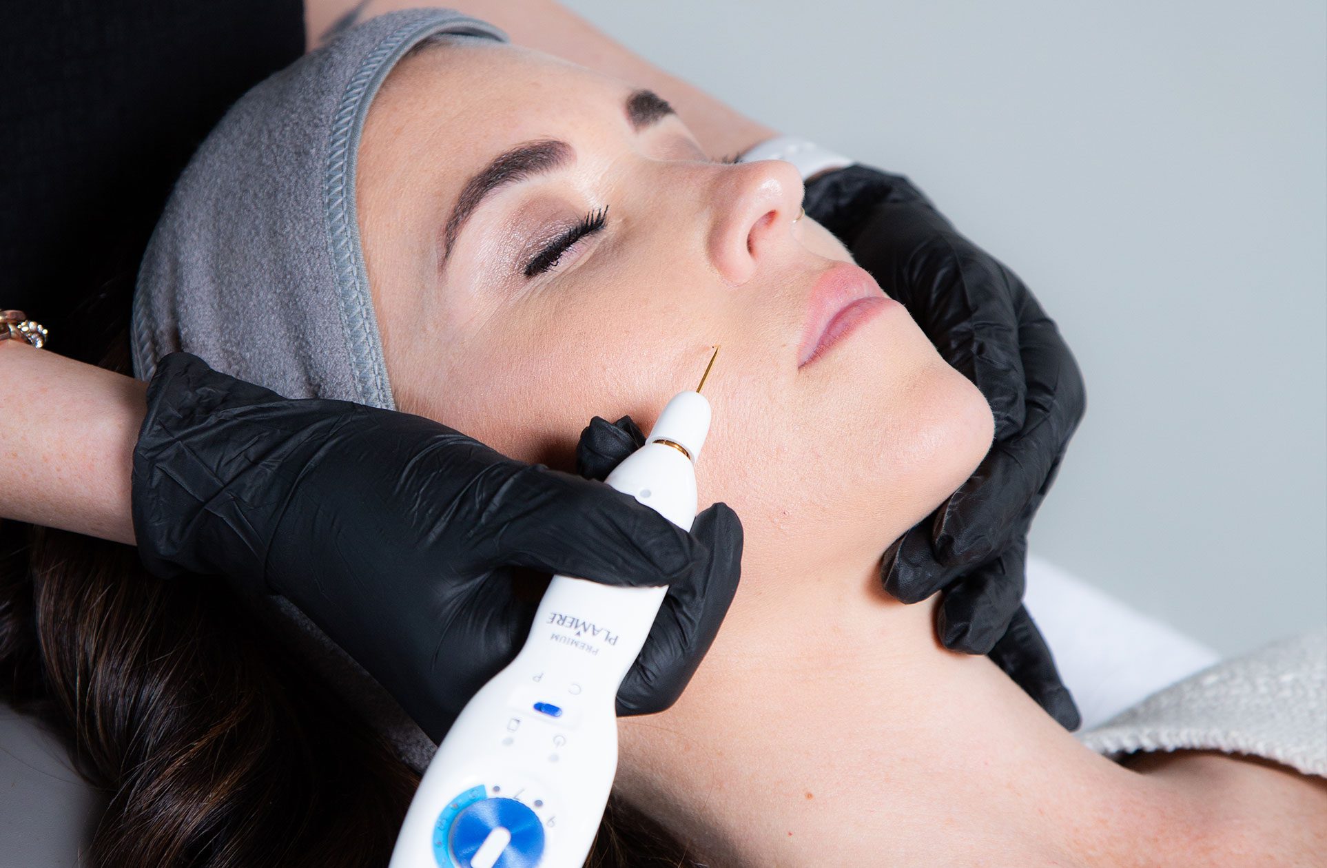 Fibroblasting Pen Treatment