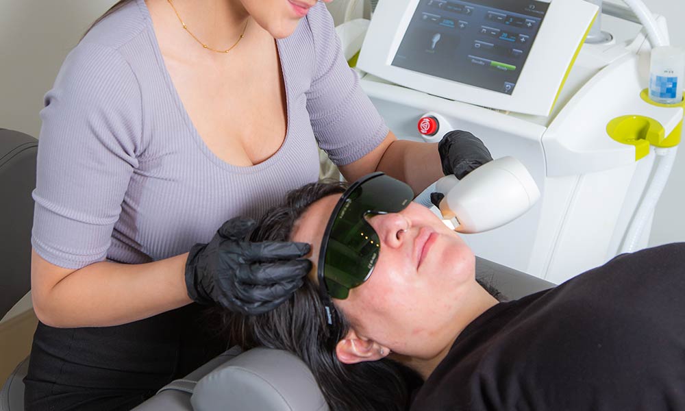 ipl-photofacial